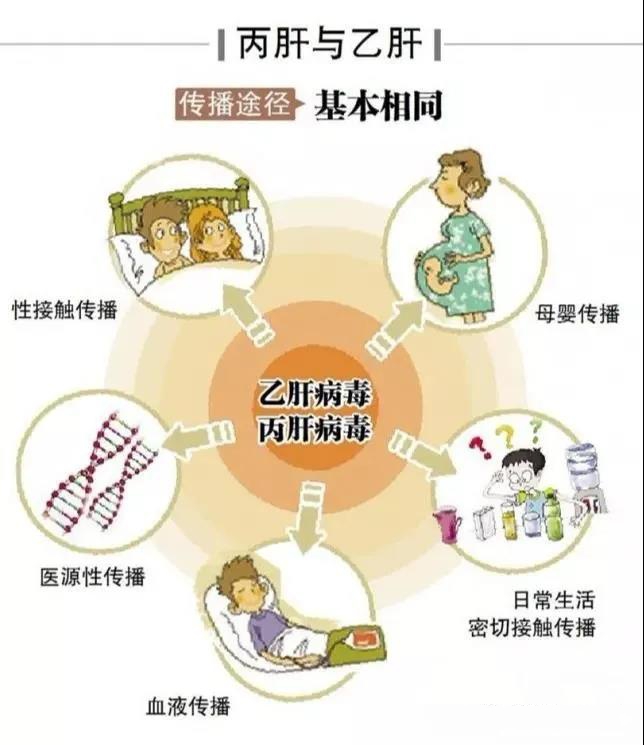 得了丙肝严重吗该怎样保护肝脏